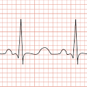 logo L'électrocardiogramme (ECG)